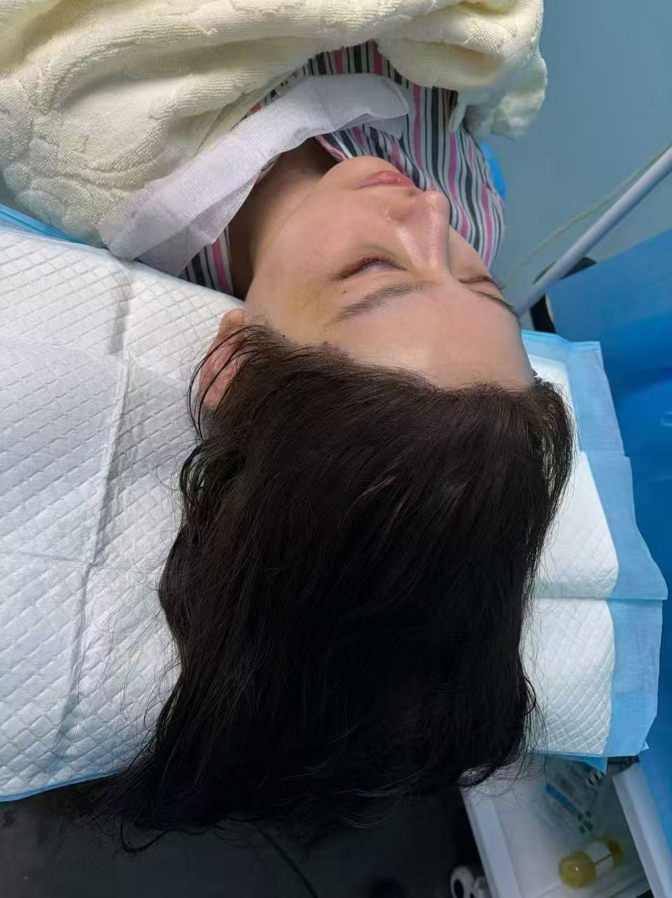 Client 1 after, first hairline view