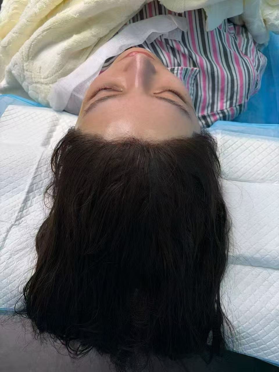 Client 1 after, second hairline view