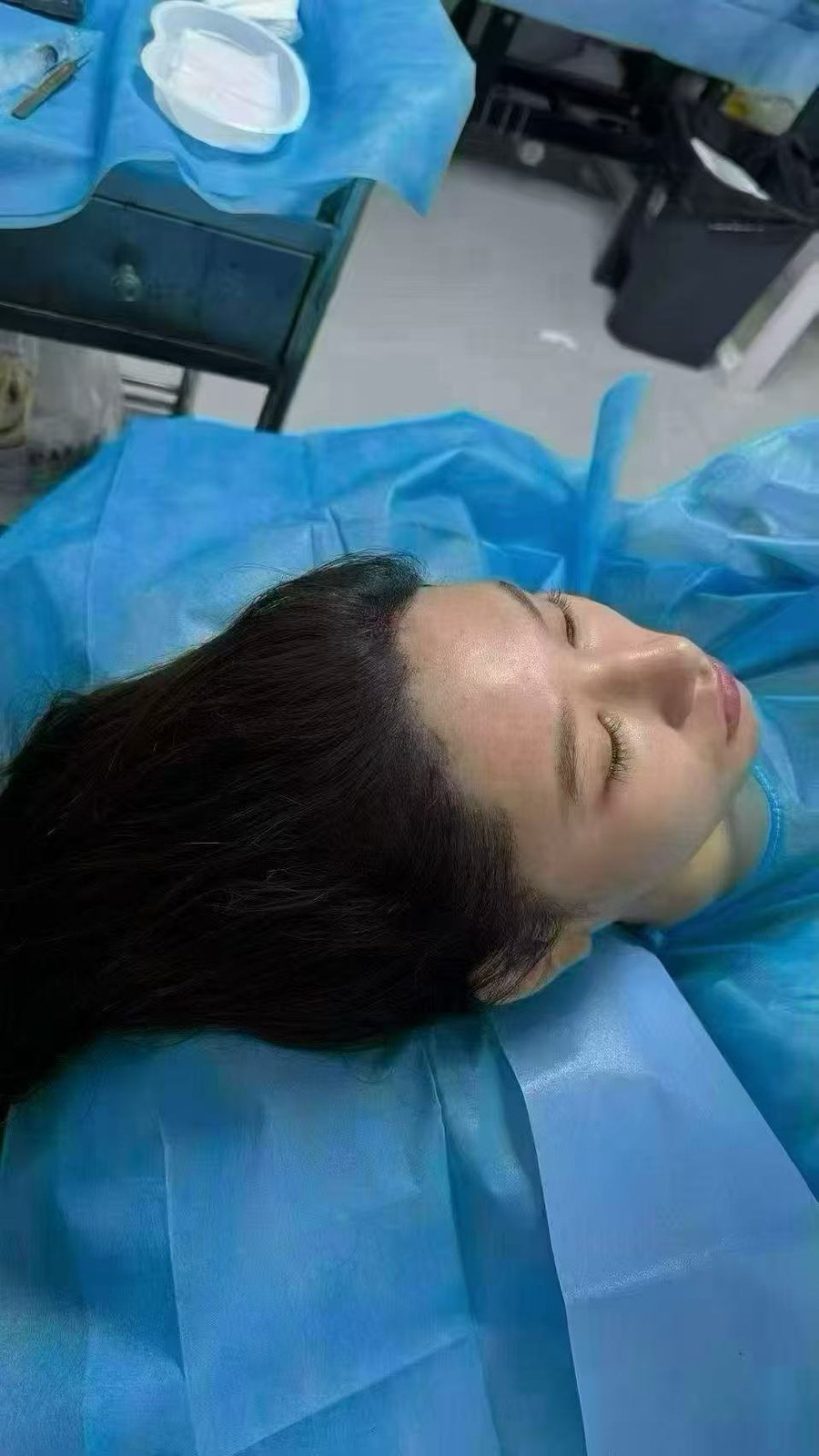 Client 2 after, fourth hairline view