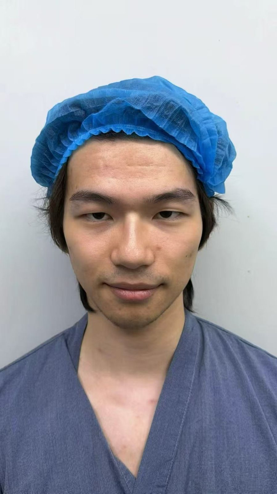 Client A before, frontal portrait in clinical attire